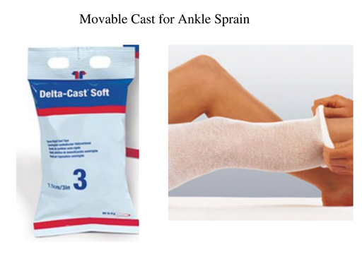 Movable Cast for Ankle Sprain